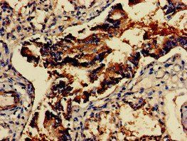 GAD2 Antibody
