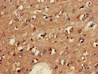 GAD2 Antibody