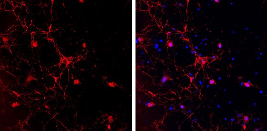 GAD65 Rabbit Polyclonal Antibody