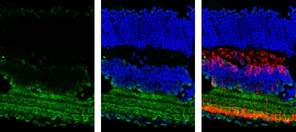 GAD65 Rabbit Polyclonal Antibody