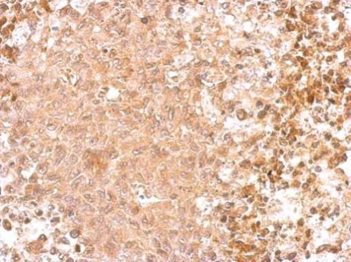 GAD65 Rabbit Polyclonal Antibody