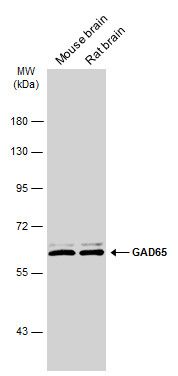 GAD65 Rabbit Polyclonal Antibody