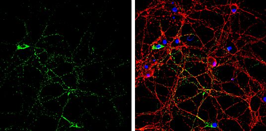 GAD65 Rabbit Polyclonal Antibody