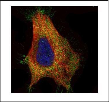 GAD65 Rabbit Polyclonal Antibody