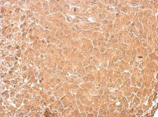 GAD65 Rabbit Polyclonal Antibody
