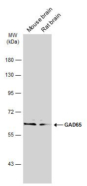 GAD65 Rabbit Polyclonal Antibody