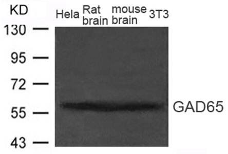 GAD65(GAD2) Rabbit Polyclonal Antibody