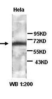 GAD65 Rabbit Polyclonal Antibody