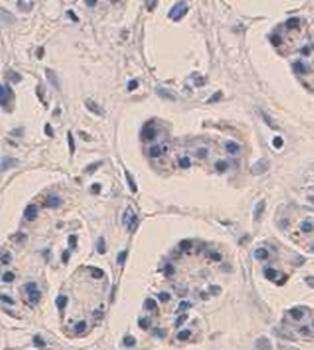 GAD65 Rabbit Polyclonal Antibody