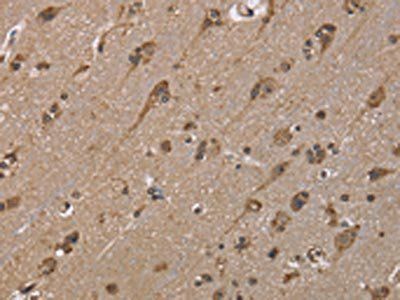 GADD45B Antibody