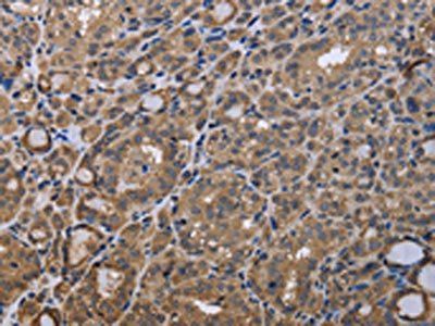 GADD45B Antibody