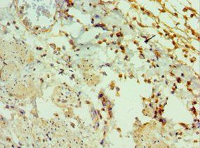 GAL Antibody