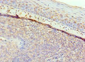 GAL Antibody