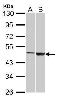 CSB antibody [N2C1], Internal