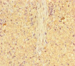 GALT Antibody
