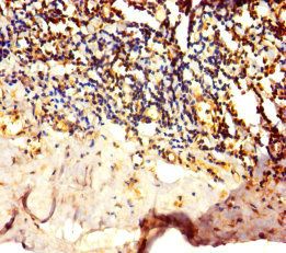 GALT Antibody