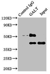 GALT Antibody