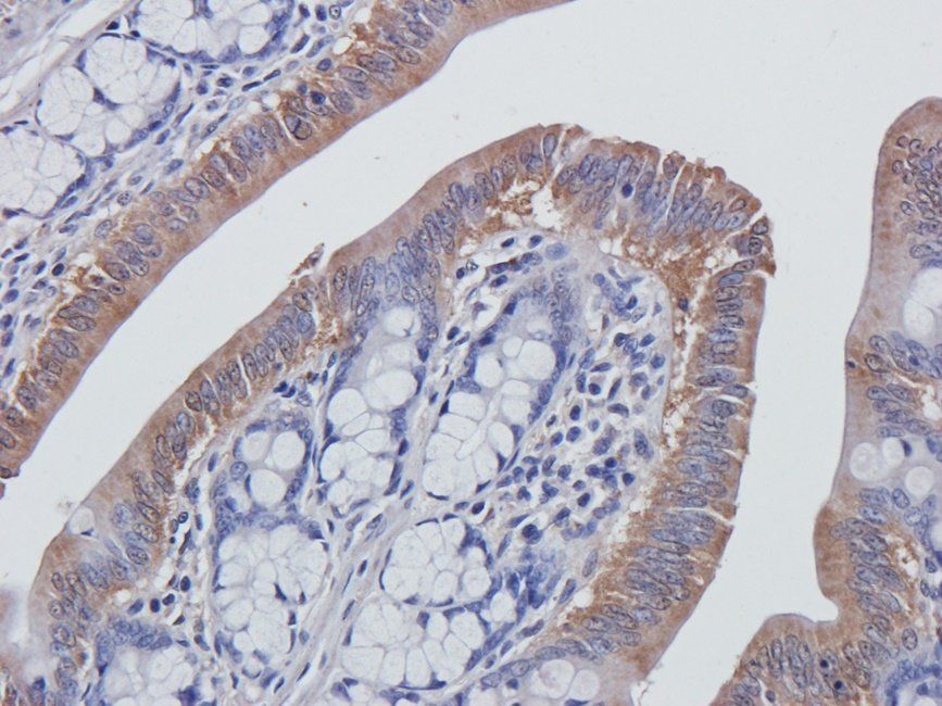 Galanin Rabbit Polyclonal Antibody