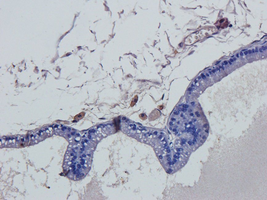Galanin Rabbit Polyclonal Antibody