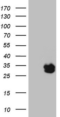 Galectin 3 Antibody