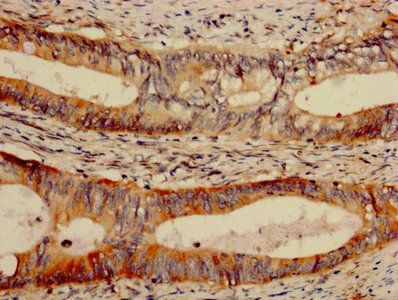 LGALS7 Antibody