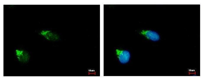 GALNT2 Rabbit Polyclonal Antibody