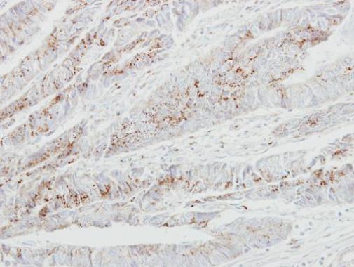 GALNT2 Rabbit Polyclonal Antibody