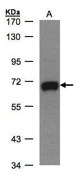 GALNT2 Rabbit Polyclonal Antibody