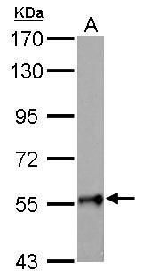 GALNT2 Rabbit Polyclonal Antibody