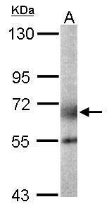 GALNT2 Rabbit Polyclonal Antibody