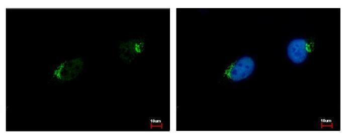 GALNT7 Rabbit Polyclonal Antibody