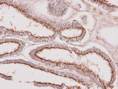 GALNT7 Rabbit Polyclonal Antibody