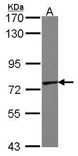 GALNT7 Rabbit Polyclonal Antibody
