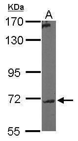 GALNT7 Rabbit Polyclonal Antibody