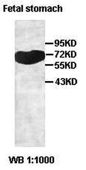 GALNT7 Rabbit Polyclonal Antibody