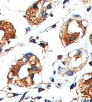 GALNT7 Rabbit Polyclonal Antibody