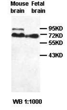 GALNT9 Rabbit Polyclonal Antibody