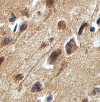 GALNT9 Rabbit Polyclonal Antibody