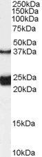 GALR1 (internal) Antibody