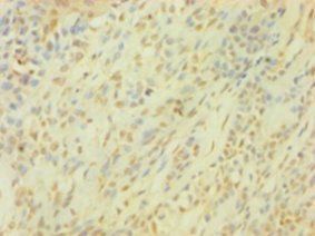 SNCG Antibody