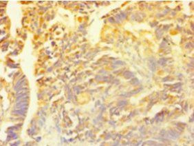 SNCG Antibody