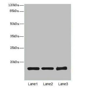 SNCG Antibody