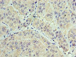 GAN Antibody