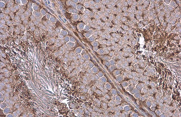 GAPDH antibody