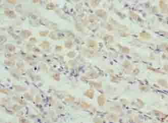 GRP Antibody