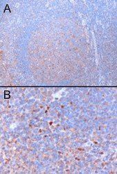 GATA3 Antibody