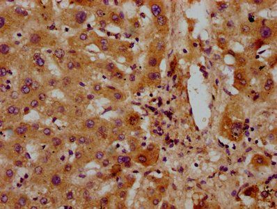 GATB Antibody