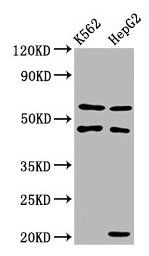 GATB Antibody