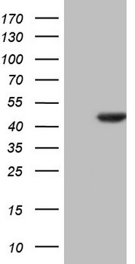 GBA Antibody