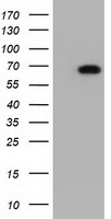 GBE1 Antibody